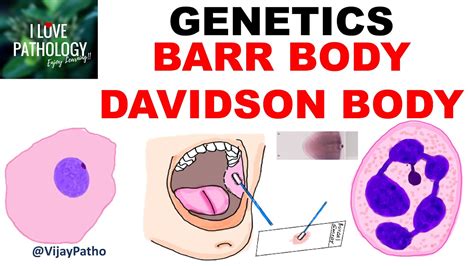 Barr Bodysex Chromatin Davidson Body Youtube