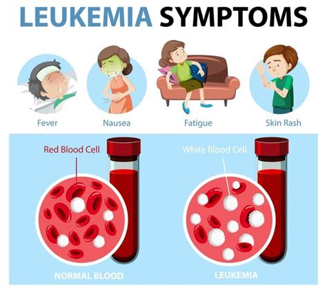 Free Vector Leukemia Symptoms Cartoon Style Infographic