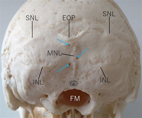 The Inferoposterior View Of A Human Skull Showing The External