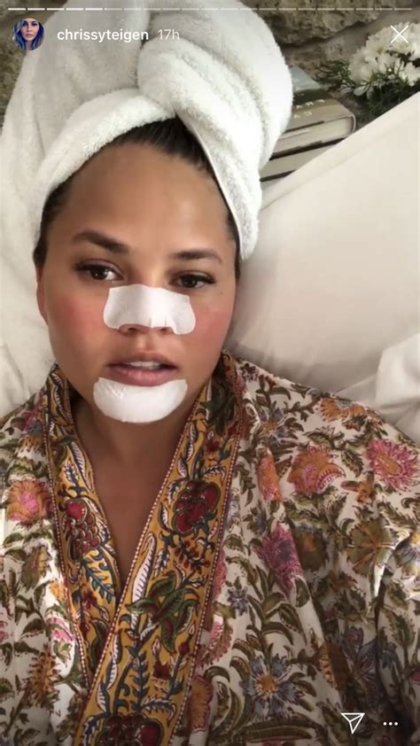 Chrissy Teigen Relatable Human Also Stares At Her Pore Strips Glamour