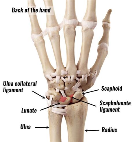 Tfcc Tear Hand Surgery Bones And Muscles