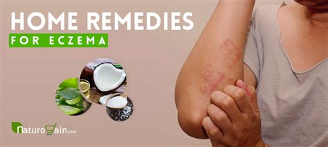Eczema Skin Rashes Treatment Images And Photos Finder