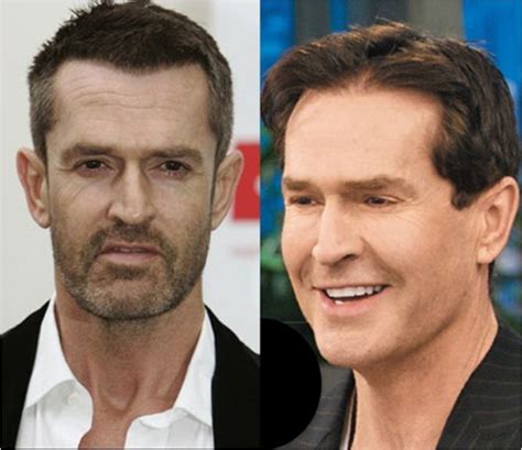 50 Famous Men Who Have Done Plastic Surgery Ritely