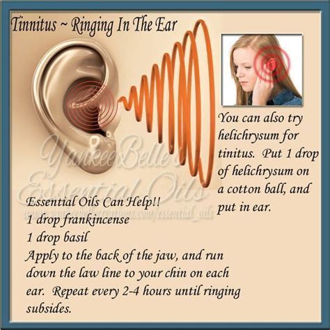 Pin On Tinnitus Remedies