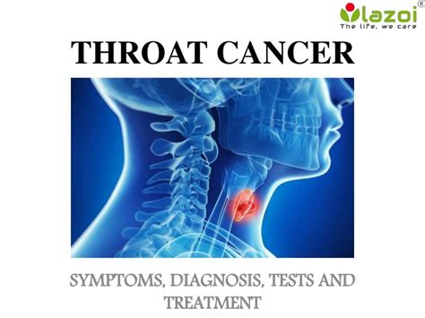 Throat Cancer Symptoms Diagnosis Tests And Treatment