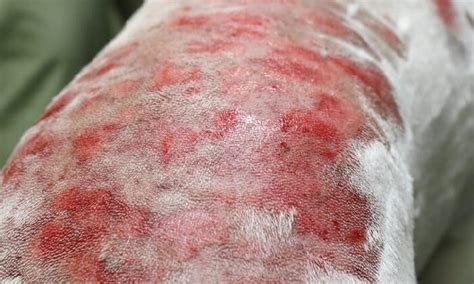 Dog Skin Conditions 12 Examples With Pictures Skin Care Geeks