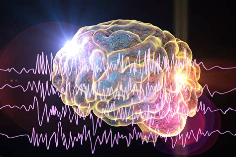 Risk Factors And Causes Of Epilepsy