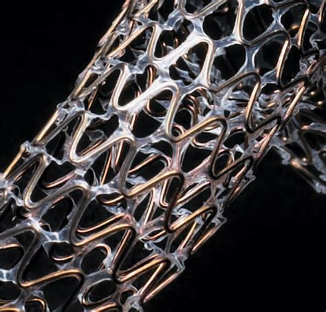 Fda Clears Gore Tigris Vascular Stent For Treatment Of