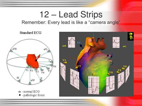 Ppt Rhythm And 12 Lead Ekg Review Powerpoint Presentation