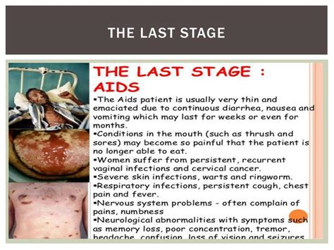 Ppt Hiv And Aids Powerpoint Presentation Free Download Id6183937