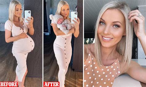 Australian Model Hannah Polites Stuns With Before And After Pregnancy Photos In Same Dress