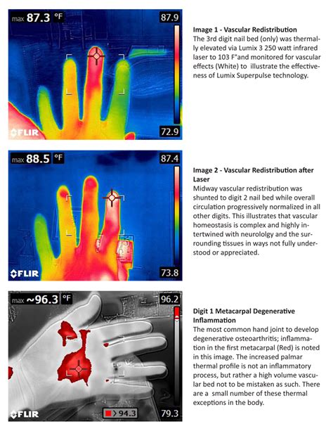 Ir Image Library — Spinal Reflex Institute Intl Copy