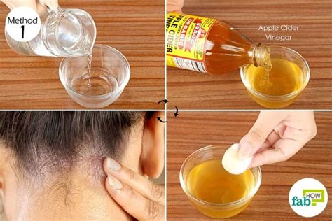 Apply Diluted Apple Cider Vinegar On Your Scalp And Other Affected