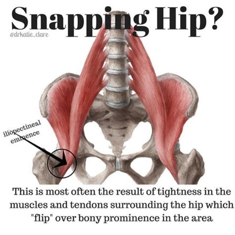Upper and inner thigh common functions: #tiptuesday . Popping or snapping hip have you annoyed? Don't be annoyed- just get it fixed! Dr ...
