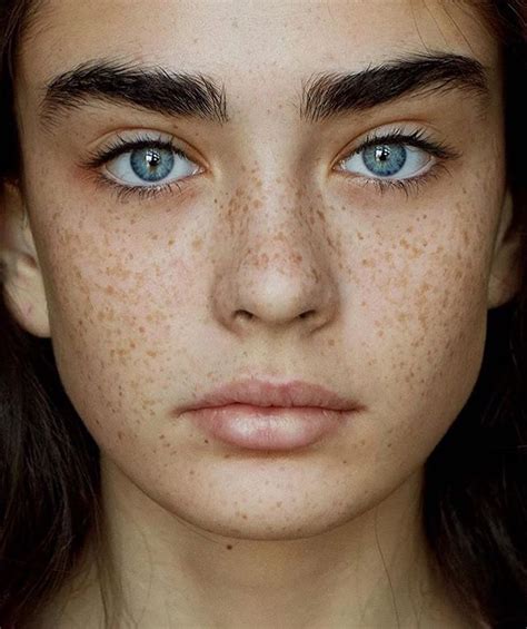 a woman with freckled hair and blue eyes looks directly at the camera while she has freckles on