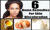 Home Remedies Skin Care Photos