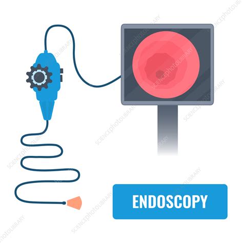 Endoscopy Equipment Illustration Stock Image F0370644 Science
