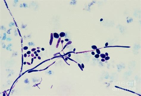 Lm Of Candida Photograph By John Durhamscience Photo Library Fine