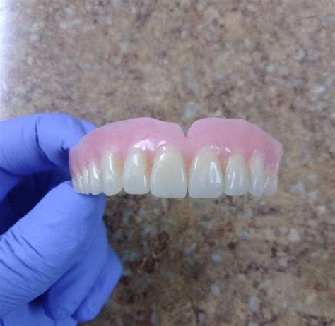 Upper U Shape Horseshoe False Teeth Denture False Teeth Cosmetic