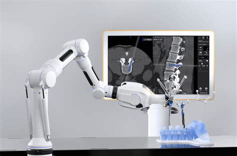 Cirq® Robotics A Portable And Versatile Surgical Robotic Assistant For O R Brainlab