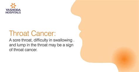 First Signs Of Throat Cancer Pictures