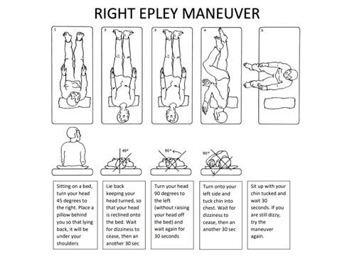 √ Epleys Maneuver Modified Epleys Left It Is Also