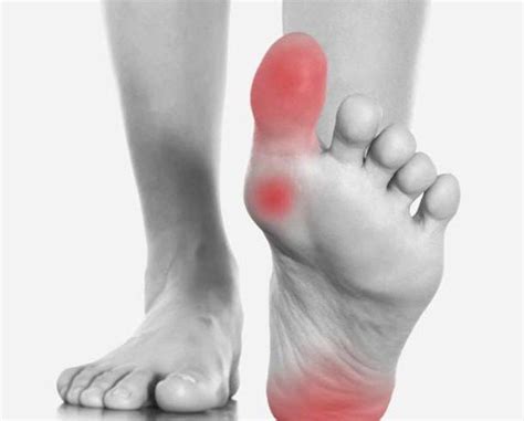 Types Of Arthritis That Affect Your Feet Lucky Feet Shoes