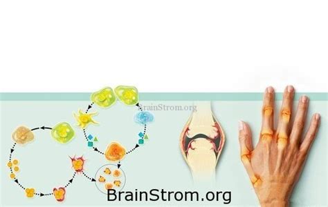 Rheumatoid Arthritis Mechanism Brainstrom