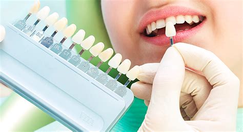 ¿qué Es El Composite Dental ¿cuándo Se Utiliza Vitaldent