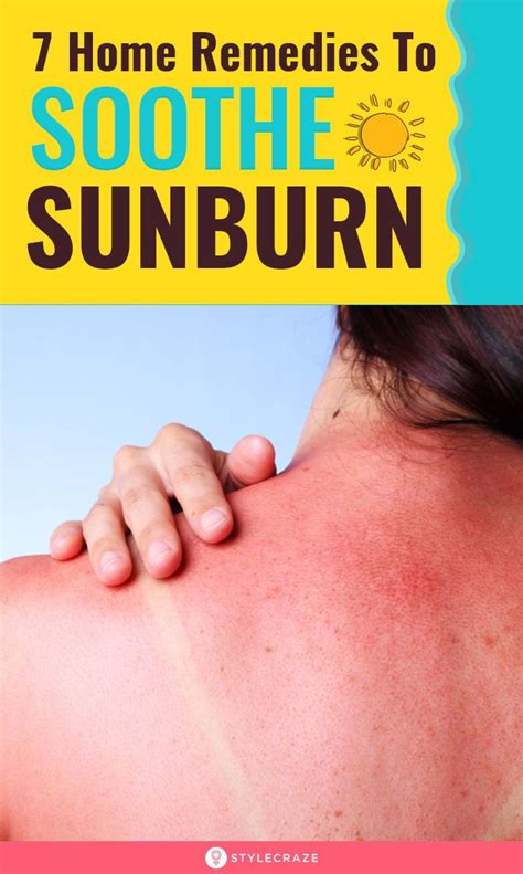 Sunscreen Tips And Tricks Stylecraze Soothe Sunburn Sunburn