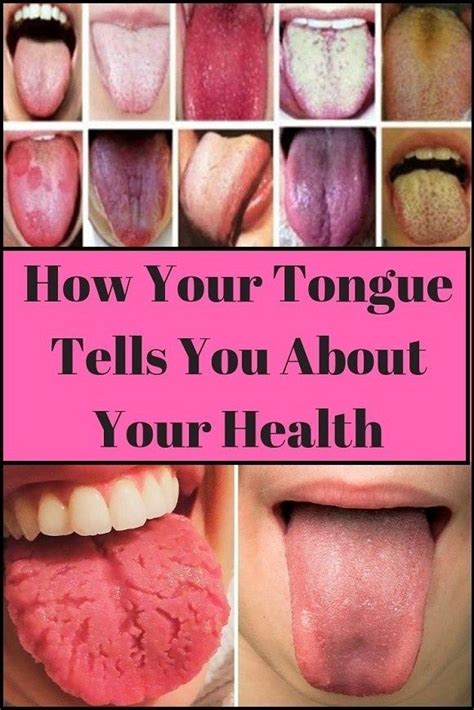 What Your Tongue Says About Your Health Be Healthy Natural Teething