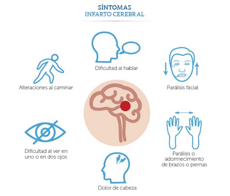 Médica Sur Symtom på stroke Localizador