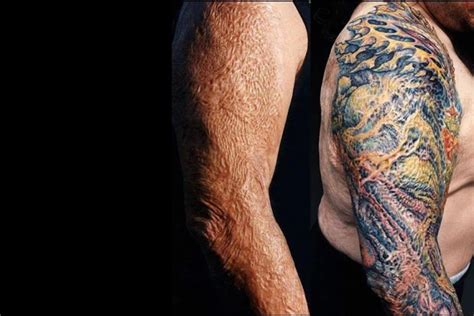 10 tattoos covering scars that are so beautiful and cool
