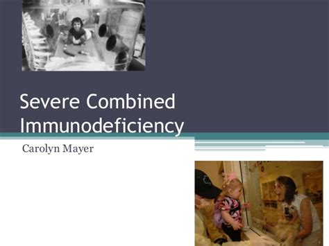 Severe Combined Immunodeficiency