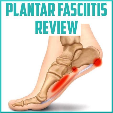 Plantar Fasciitis Symptoms And Causes Mayo Clinic Vlrengbr
