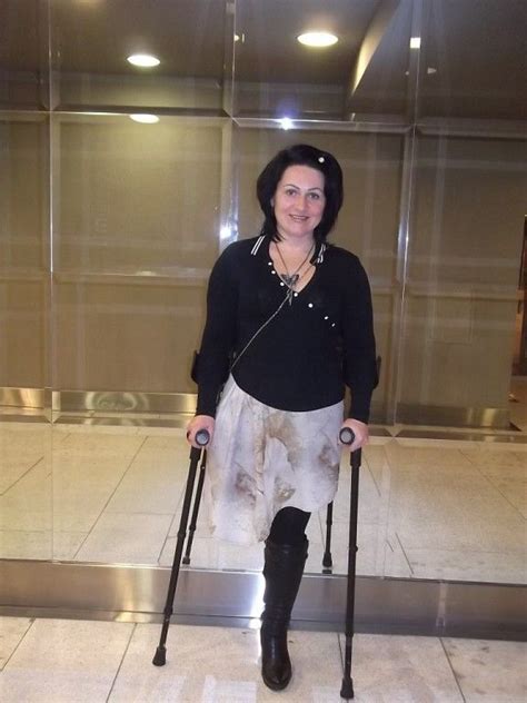 Amputee On Crutches Krücken Frau Amputiert