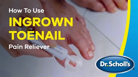 Ingrown Toenail Treatment And Pain Relief Dr Scholls®
