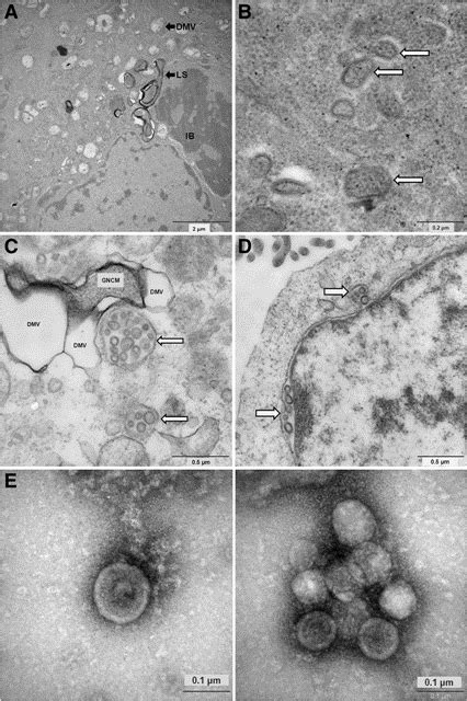 Dr Lednicky Et Al Discovered Human Coronavirus Nl63 Hcov Nl63 In