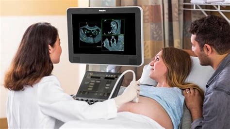 Philips Obgyn Ultrasound Enhanced With Fetview News Philips