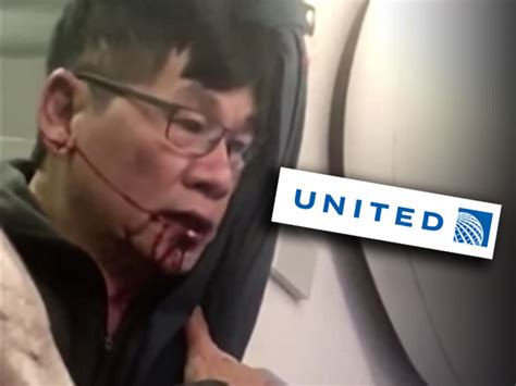 The Source Experts Say The United Passenger Dragged Off Plane Has A Strong Legal Case