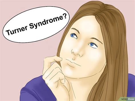 Come Diagnosticare La Sindrome Di Turner 11 Passaggi