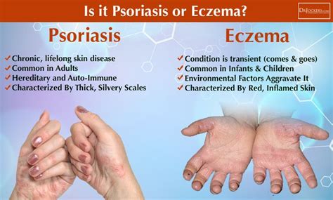 What Is The Difference Between Psoriasis And Eczema Psoriasis