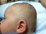 Baby Flat Head
