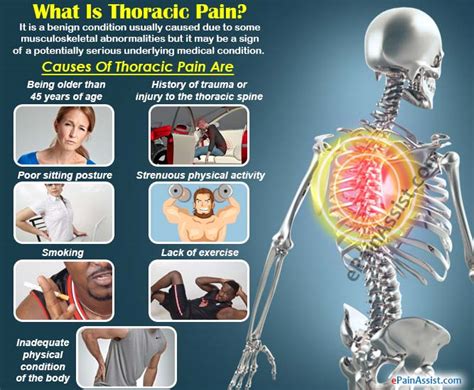 Thoracic Pain Treatment Causes Symptoms Diagnosis