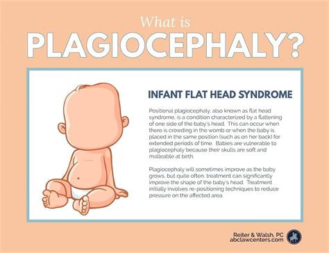 Positional Plagiocephaly And Infant Flat Head Syndrome