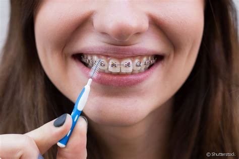 escova interdental é descartável descubra a maneira certa de usar o produto de higiene bucal