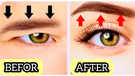 Mins Eyebrow Lift Exercise Massage Fix Droppy Eyelids Make Your Eyes Bigger Naturally Youtube