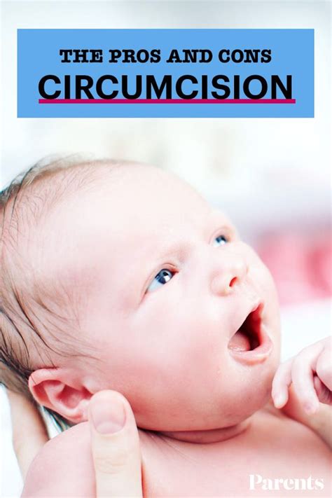 The Pros And Cons Of Circumcision Artofit