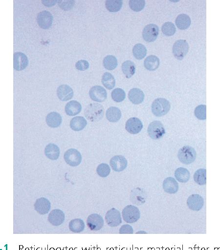 Figure 121 1 From Chapter 121 Anemia Polycythemia And White Blood