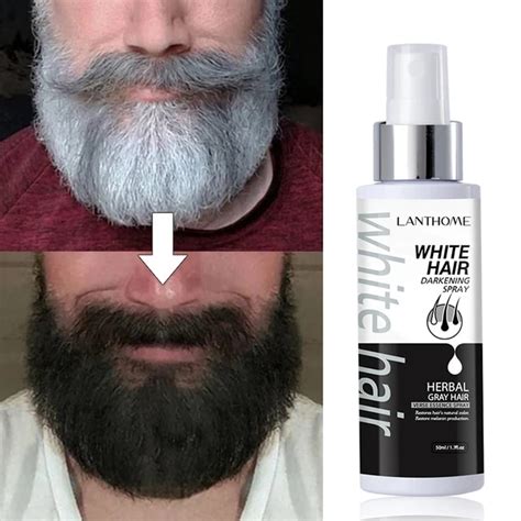 Aggregate 147 Beard White Hair Treatment Super Hot Dedaotaonec